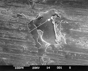 Figure 28. Closer view of bearing race pitting, also showing remelted globules.