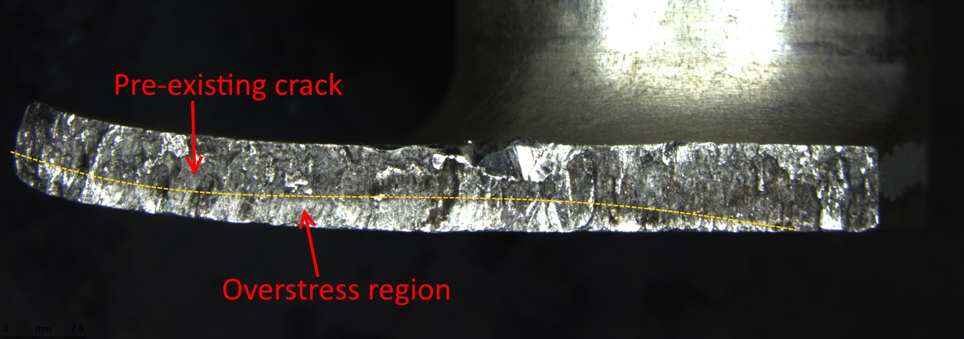 Figure 3: Fracture surface illustrating the pre-existing crack and the overstress region, which fractured when the bracket finally failed.