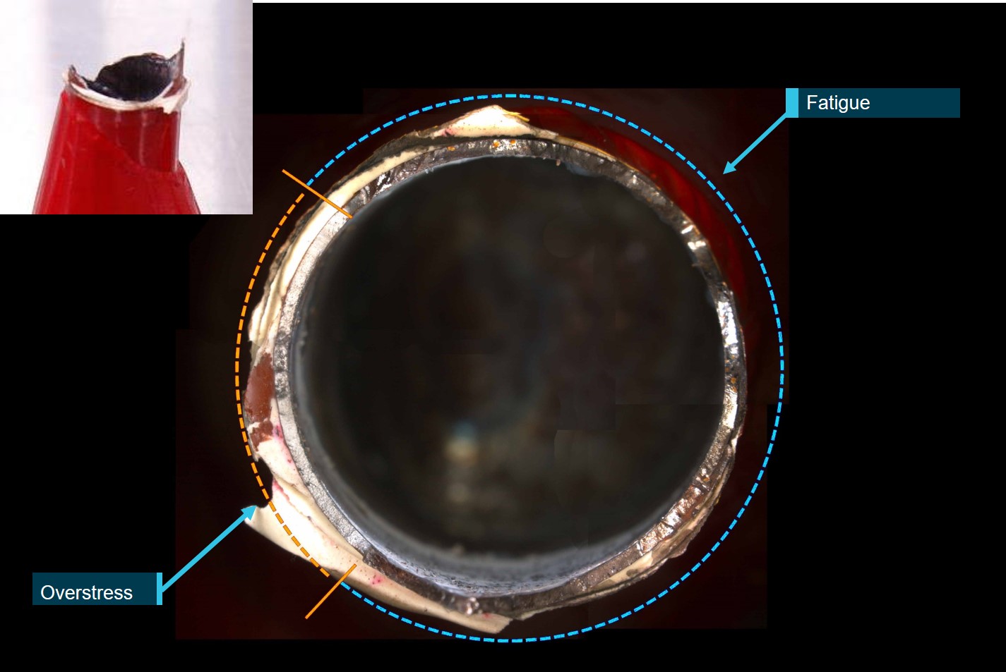 Figure 6: Stabiliser fracture surface showing fatigue and overstress areas.<br />
Source:  ATSB