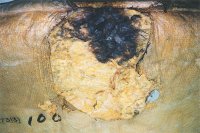 Figure 1: VH-CZB damaged insulation blanket